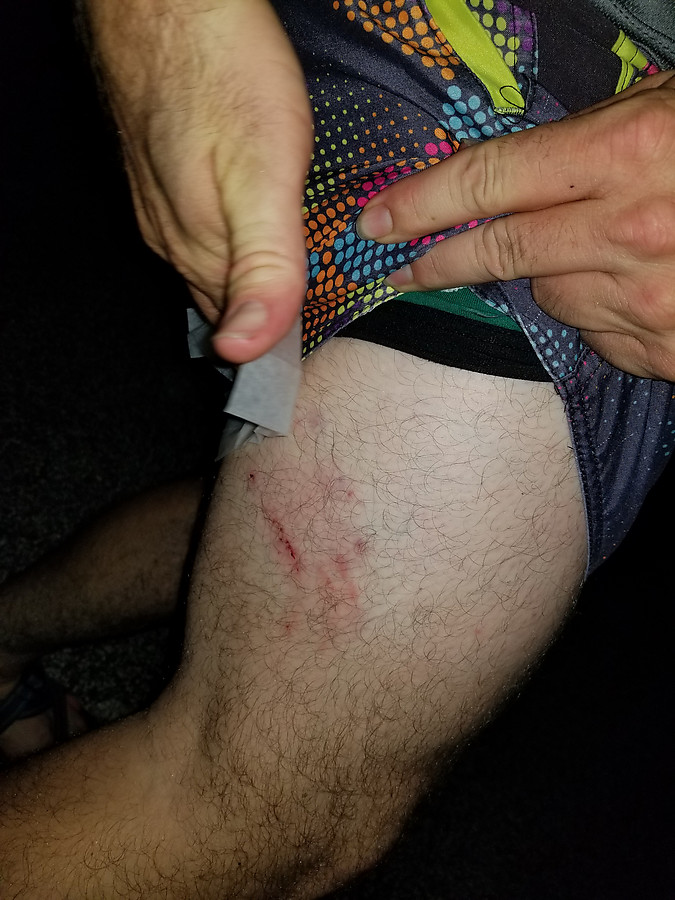 Joshua got bitten by a doberman being walked by a guy in an NRA shirt who lives in the Wickham park campground